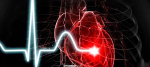 2-heartdisease